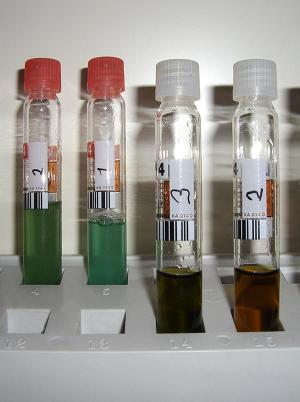 Forschung Anaerobe Abwasserreinigung